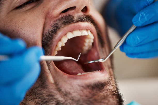 Best Chipped Tooth Repair Near Me  in Sardis City, AL